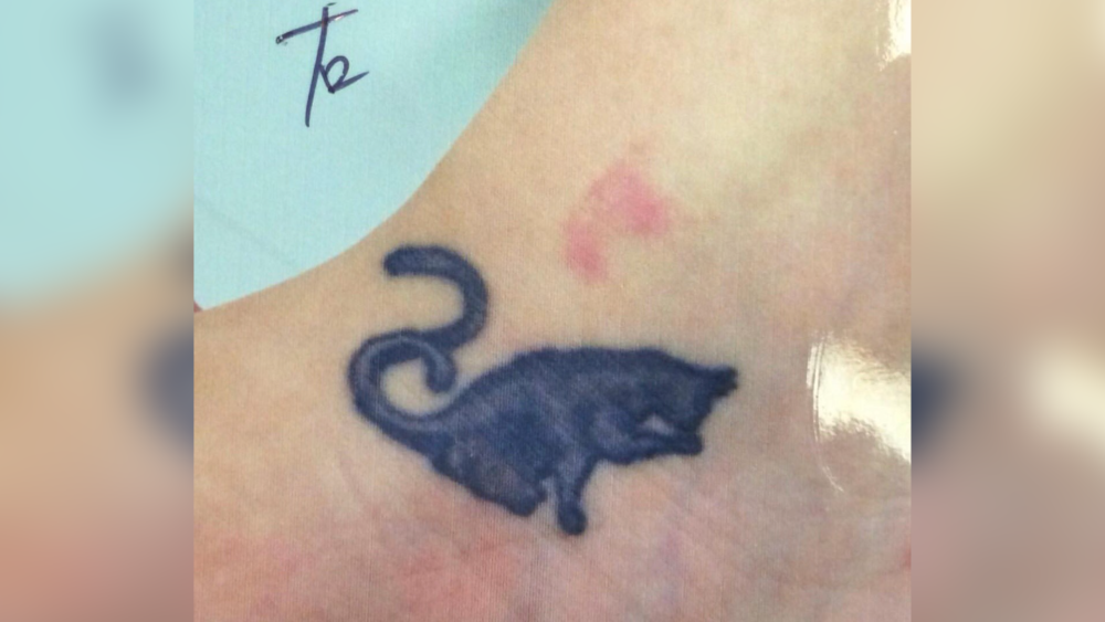 タトゥー除去｜猫のタトゥー
